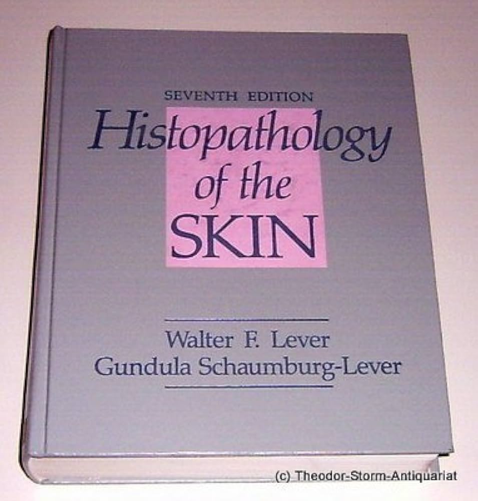 健康・医学 Levers histopathology of the skin Lever's Histopathology of the Skin: 9780781737425: Medicine